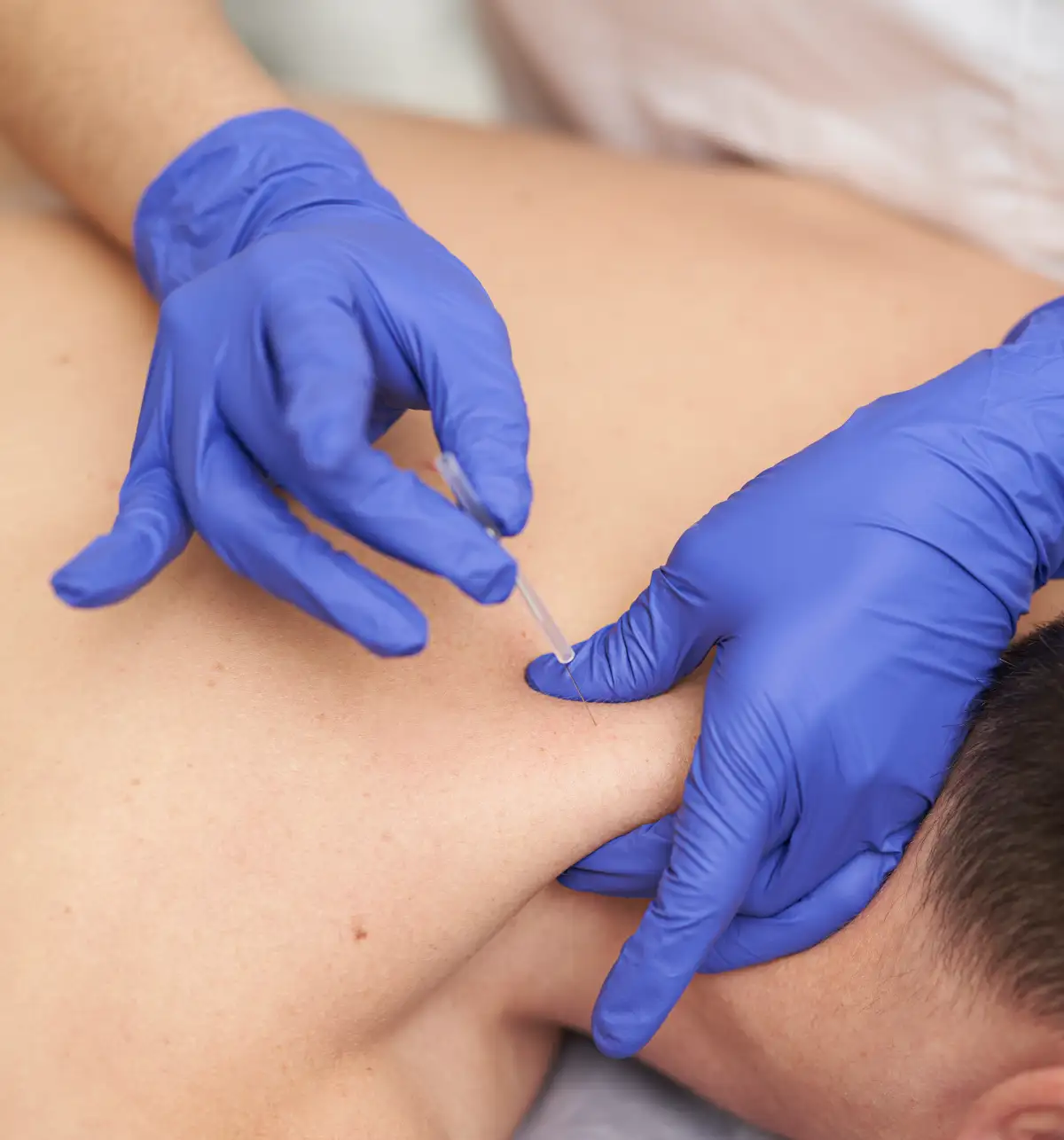 Fisioterapia - Clinica Guinova