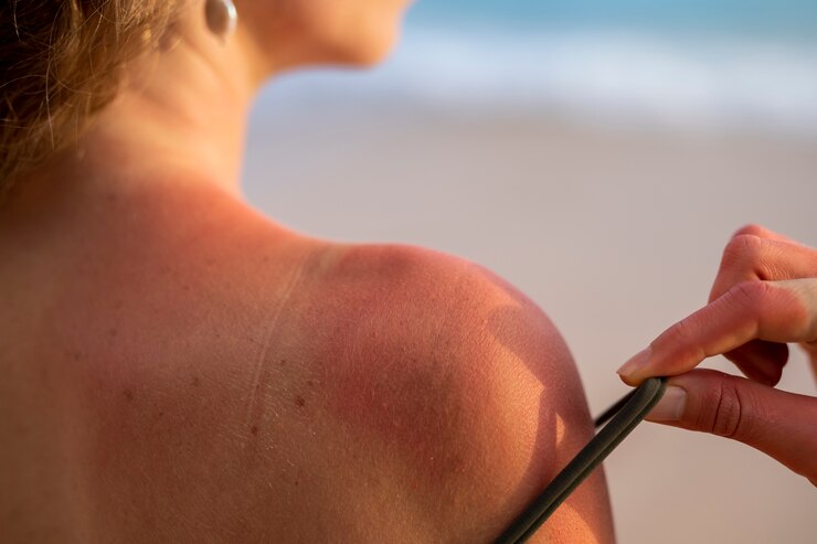 Ayuda a tu piel a reparar el daño solar del verano