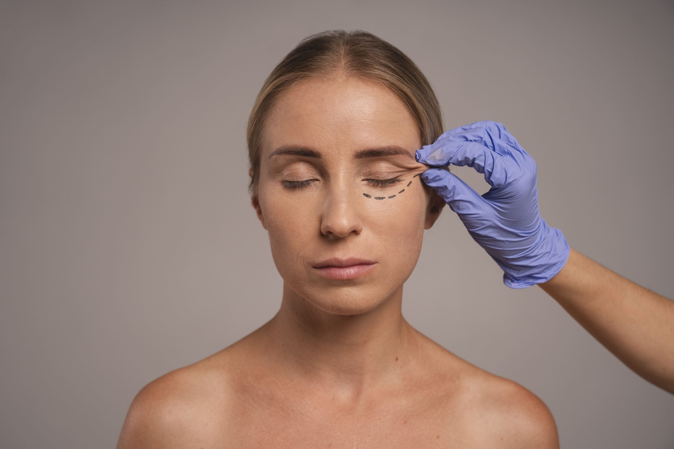 Ojeras: causa y tratamiento específico