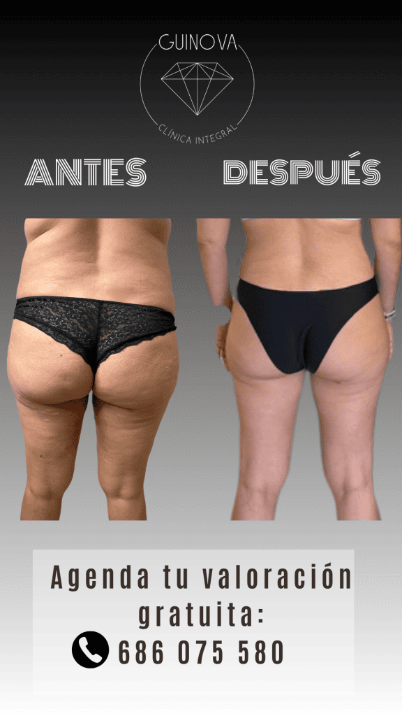 AYD VANE